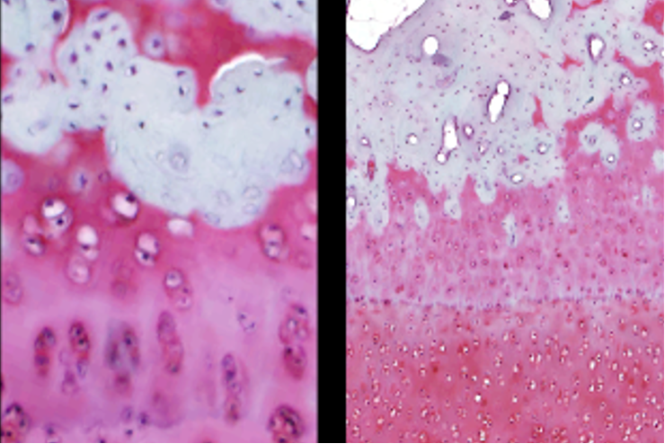 Atlas of Articular Cartilage