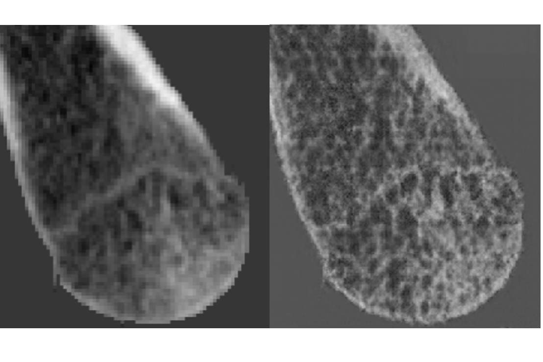CBCT Image Super-Resolution