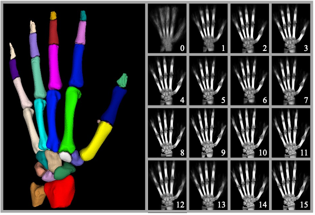 CBCT Healthy Hand Atlas